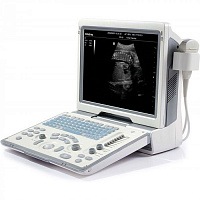 Mindray DP-50